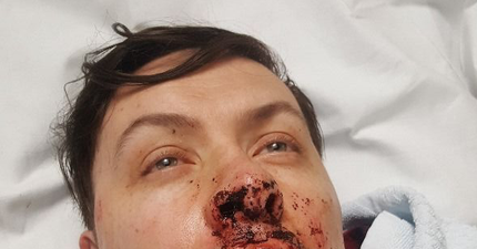 Couple left severely injured after suspected homophobic attack