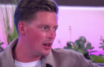 Dr Alex says he got really sunburnt in the Love Island villa because of a ‘skin condition’