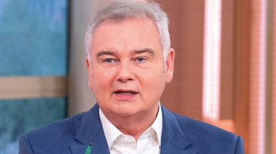 Eamonn Holmes looks like he’s been in a scrap, but really he’s just got shingles