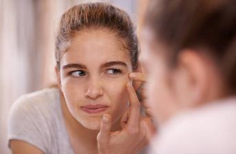 Research looked at the effect acne had on people growing up – and it’s not good