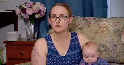 Mother injured by tennis ball-sized hailstones while protecting baby daughter from storm