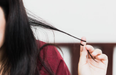 ‘A way to gain control’ Treating Trichotillomania, the hair pulling disorder
