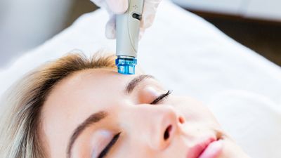 I tried the Instagram-famous Hydrafacial at Fifth Avenue, and it was such an experience