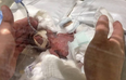 World’s smallest premature baby boy leaves hospital healthy