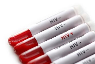 London man becomes second person to be cured of HIV, doctors say