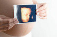 New 3D ultrasound could help detect heart defects in unborn babies
