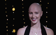 ‘Within a year, my entire head of hair was gone’: how model Amber Jean Rowan overcame her biggest insecurity