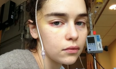 ‘Harder to stay optimistic’ Emilia Clarke shares images from brain surgery recovery