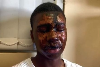 Waterford acid attack victim thought he would ‘never be able to see again’