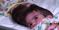 Conjoined twins successfully separated following 50 hour surgery in London