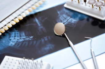 Indian boy has over 500 teeth removed after complaining of pain in his jaw