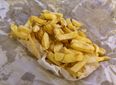 17-year-old boy goes blind after living on crisps, chips, and white bread