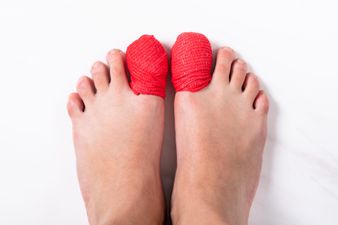 Twenty things I’ve learned from having a broken toe (the trauma!)