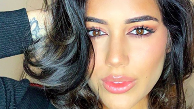 Love Island’s Malin Andersson posts harrowing image of bruise to ‘raise awareness for domestic violence’