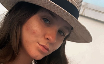 Brooke Vincent speaks candidly about struggling with her post-baby body
