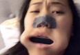 WATCH: TikToker gets harmonica stuck in mouth, goes to dentist for removal