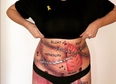 Irish singer RuthAnne shines a light on endometriosis with a powerful bodypaint picture