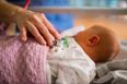Baby born with human tail at 35 weeks
