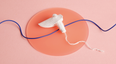 A gynaecologist has given the tampon its first notable redesign in 80 years
