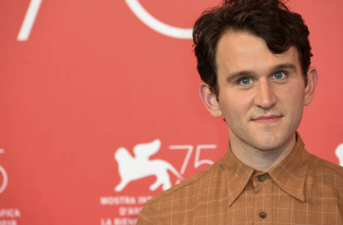 Harry Potter star Harry Melling says fans don’t recognise him after weight loss