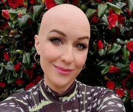 “It changed my relationship with beauty”: Journalist Mary Cate Smith discusses her alopecia journey