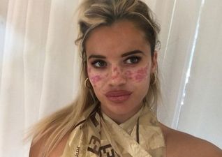 Big Brother star left temporarily blinded and scarred after TikTok DIY beauty ‘hack’