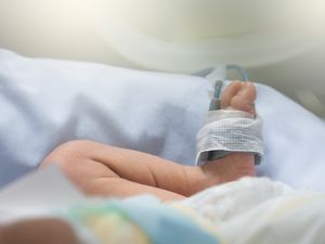 Formerly conjoined twin gives birth at hospital where she was separated from her sister