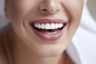 Everything you need to know about straightening your teeth at home