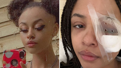 Gardaí appeal for witnesses following assault on teenage girl