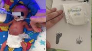 11oz baby becomes the smallest tot to survive in the UK
