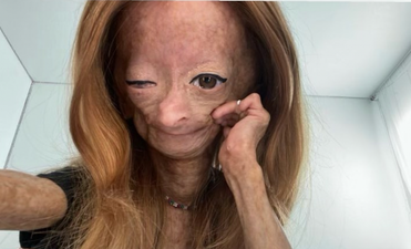 YouTube star Adalia Rose dies, aged 15