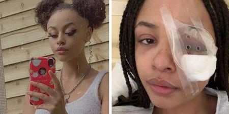 “Her sight is gone”: Mother of Alanna Idris Quinn shares update