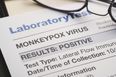 WHO advisor identifies possible source of Monkeypox outbreak