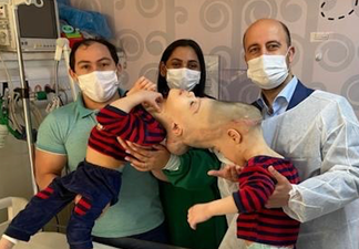 Conjoined twins with fused brains have been successfully separated