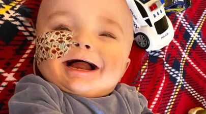 Miracle baby who was given one day live reaches first birthday milestone