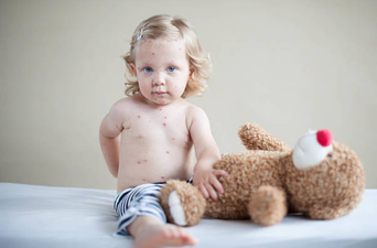 Measles warning issued to parents following outbreak in Europe