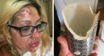 Mum left in ‘agony’ after following viral TikTok poached egg ‘hack’