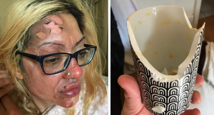 Mum left in ‘agony’ after following viral TikTok poached egg ‘hack’