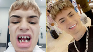 Man’s warning after Turkey teeth surgery leaves him looking ‘like a shark’