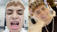 Man’s warning after Turkey teeth surgery leaves him looking ‘like a shark’