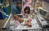 Conjoined twins return home after successful separation surgery