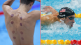 What are the dark circles on swimmers’ backs at Paris Olympics