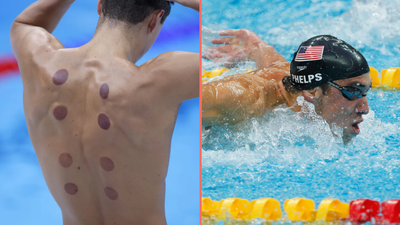What are the dark circles on swimmers’ backs at Paris Olympics