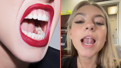 ‘Gleeking’ is the ‘disgusting’ bodily function that most people don’t know they can do