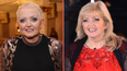 Linda Nolan dies aged 65 after 20-year cancer journey