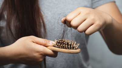 Celebrity hair stylist reveals how women can prevent hair loss