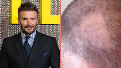David Beckham left with ‘terrible’ bald patch after trying to cut his own hair