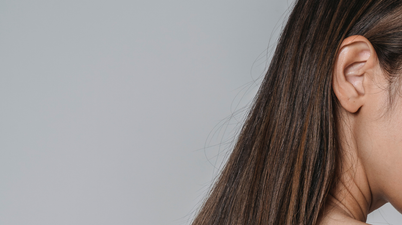 Expert reveals the best diet to help prevent hair loss