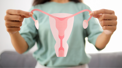 5 things all women should know about Polycystic Ovary Syndrome (PCOS)