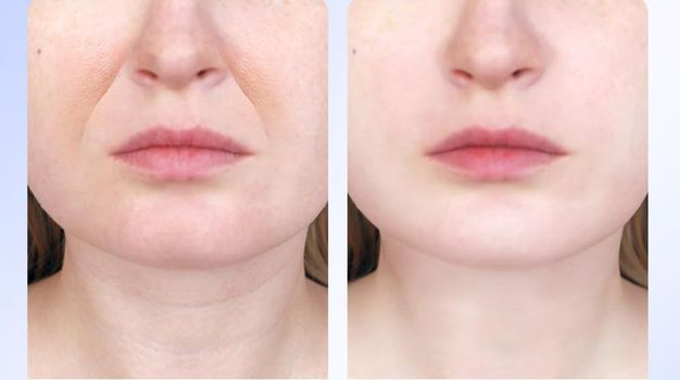 Shoppers ditch anti-ageing creams for cheap gadget designed to tighten skin